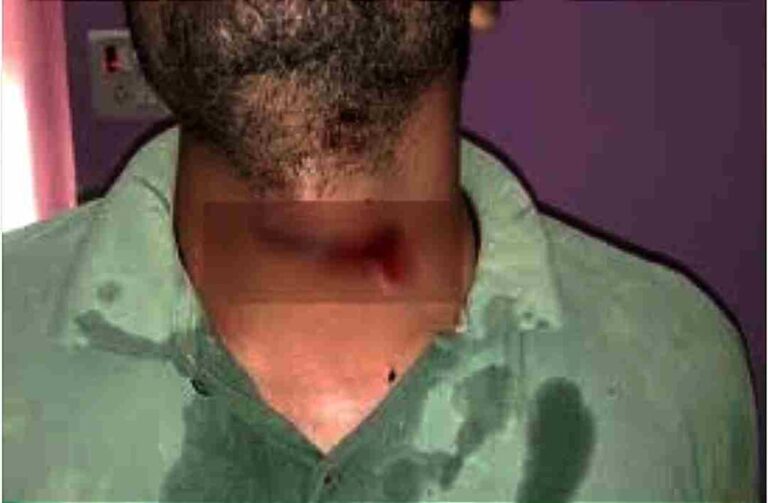 IMG_20211017_072442-1024x671